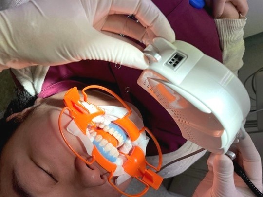 ホワイトニング - 矢野歯科医院（高槻市摂津富田）